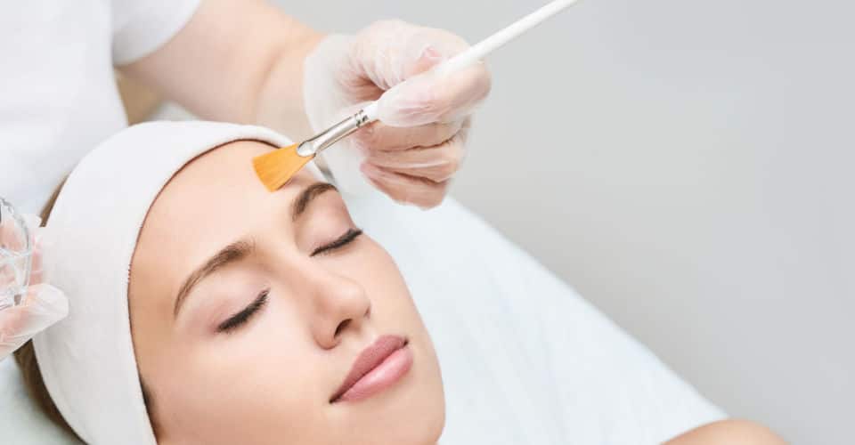 Can Chemical Peels Effectively Treat Melasma?