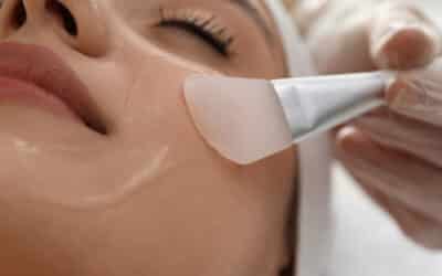 Chemical Peels Guide – Everything You Need to Know